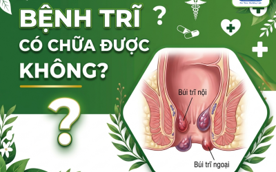 Bệnh trĩ có chữa được không? Cần điều trị như thế nào?