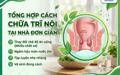 5 cách chữa trĩ nội tại nhà đơn giản, dễ thực hiện